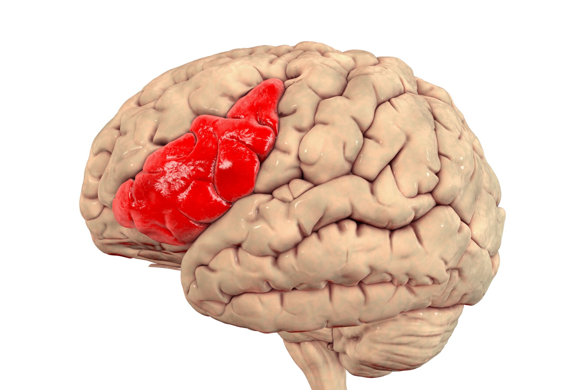 an image of the brain with broca's area highlighted 