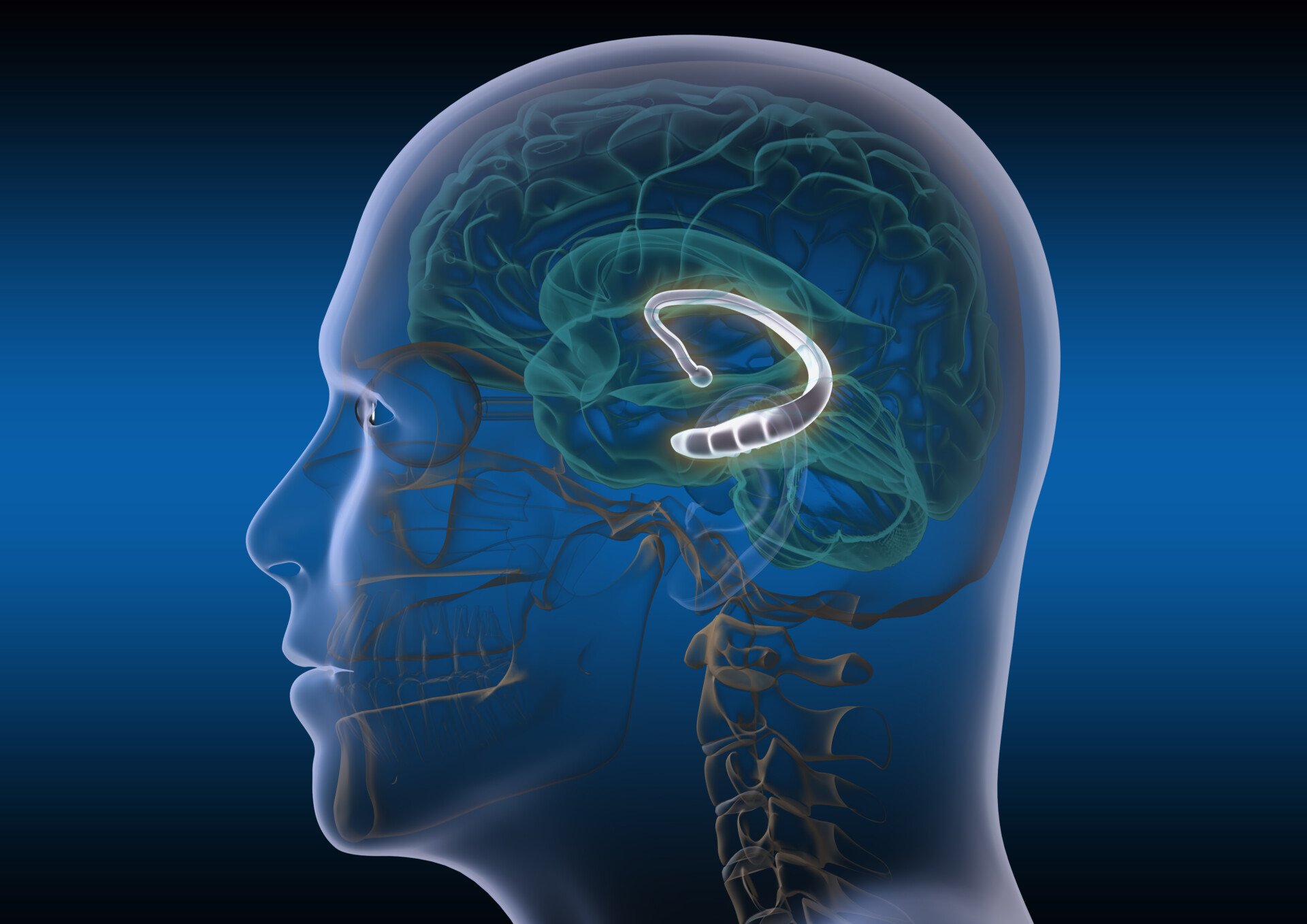 an x-ray of the head showing the location of the hippocampus