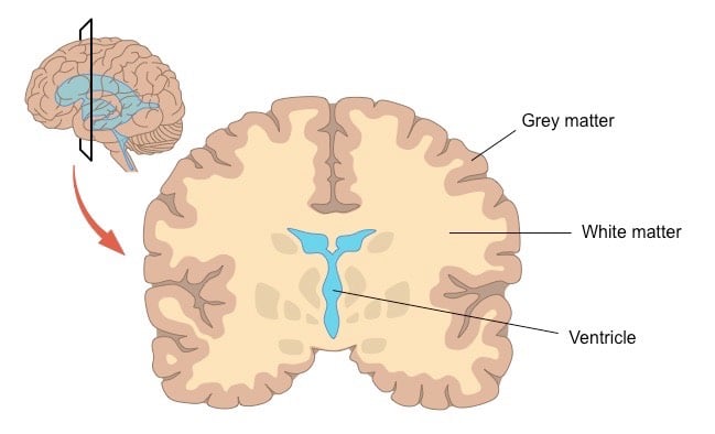 Cross-Section of the Human Brain